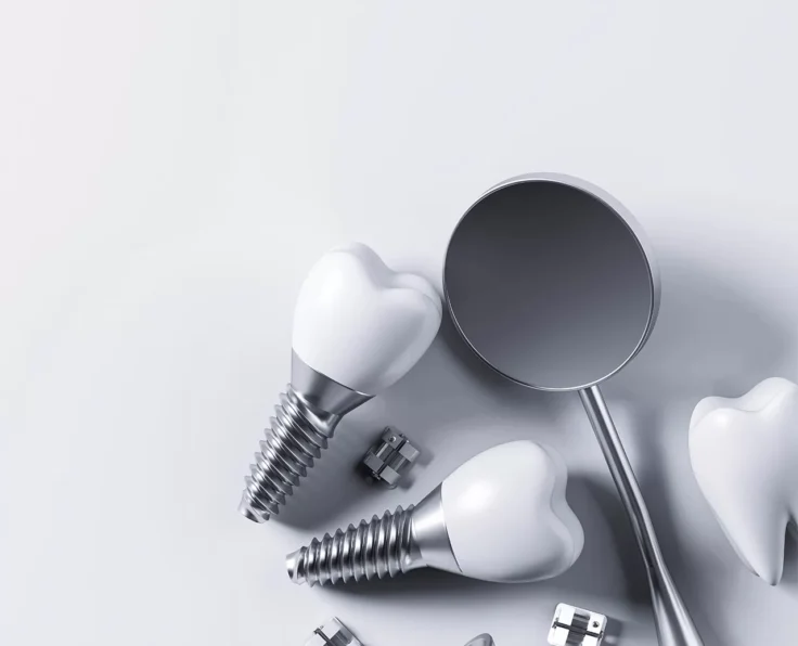 implantologia-064e427f